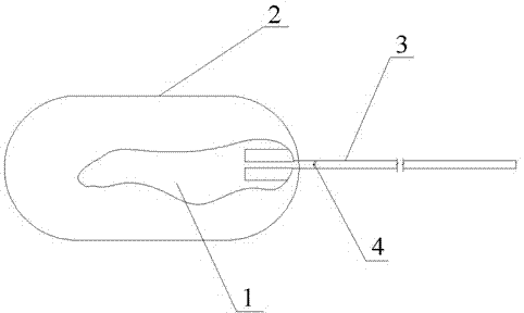 Stomach balloon weight-losing device