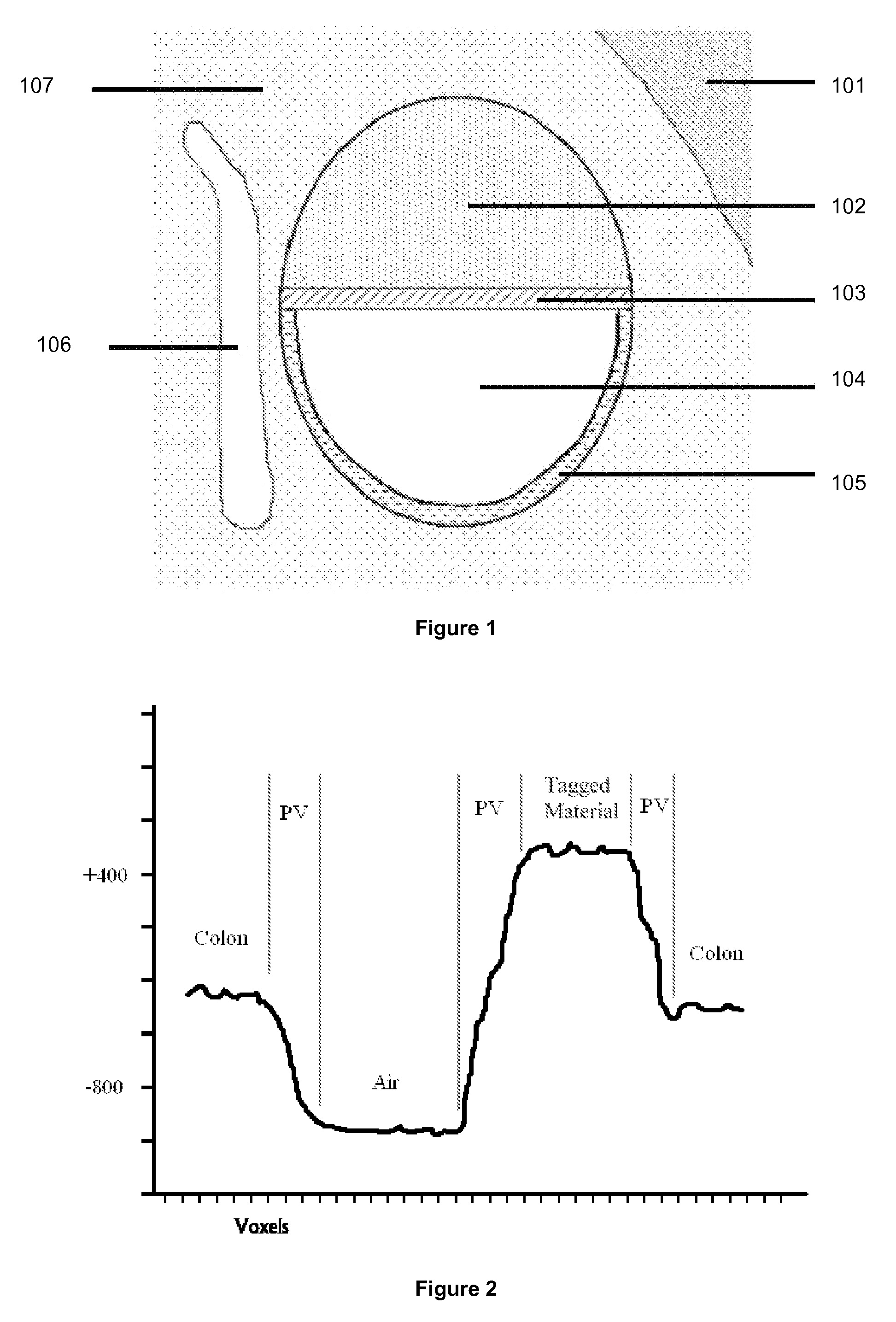 Electronic Cleansing of Digital Data Sets