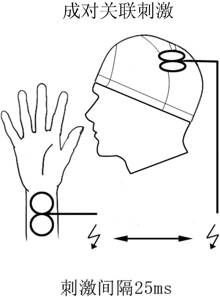 Method for treating dyskinesia after stroke based on transcranial magnetic stimulation