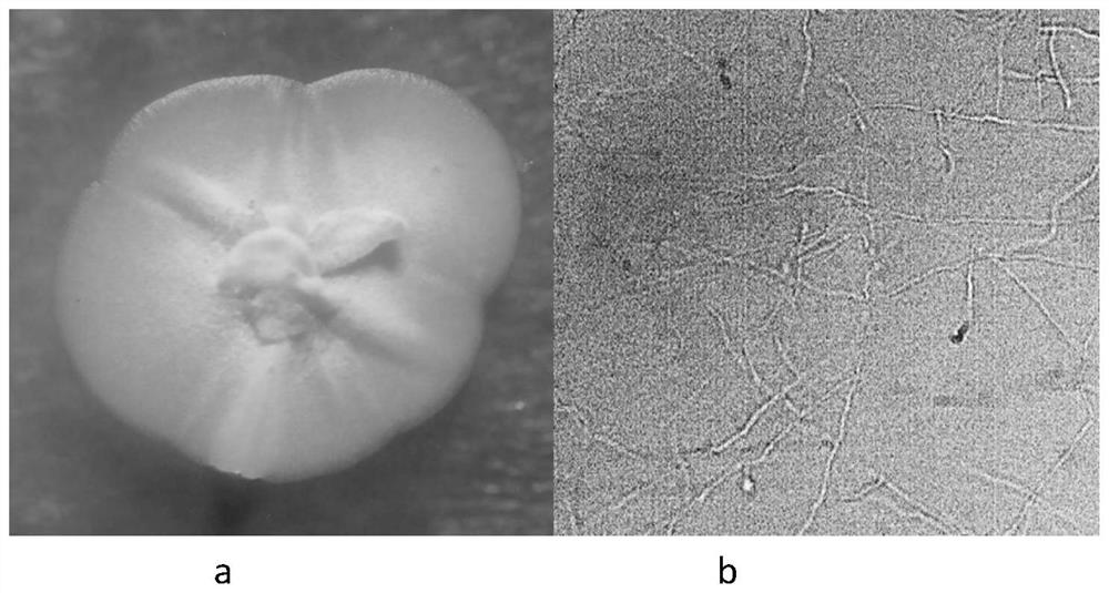 A kind of actinomycetes with inhibitory effect on peanut soil-borne pathogenic fungus and its screening method