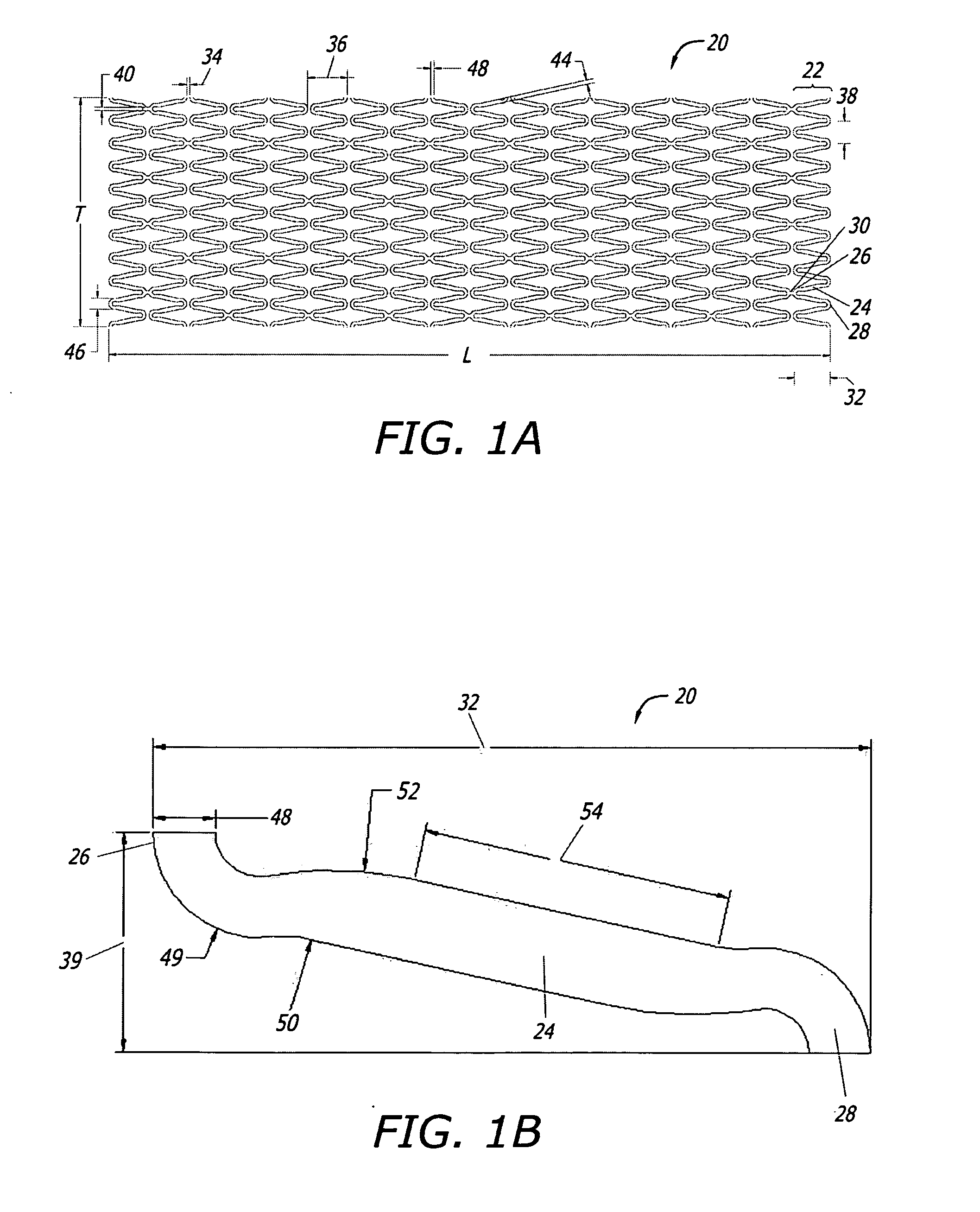 Implantable and lumen-supporting stents and related methods of manufacture and use