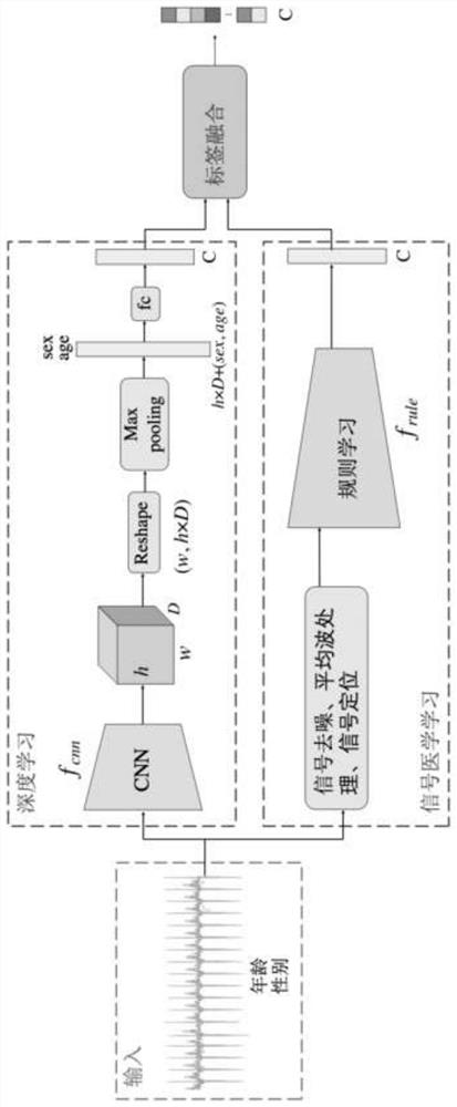 Electrocardiogram diagnosis method and device based on artificial rule enhanced neural network