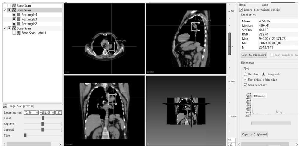 A method and system for image search by image applied to aided diagnosis and analysis of medical images