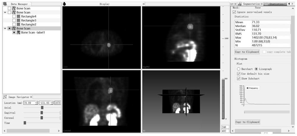 A method and system for image search by image applied to aided diagnosis and analysis of medical images