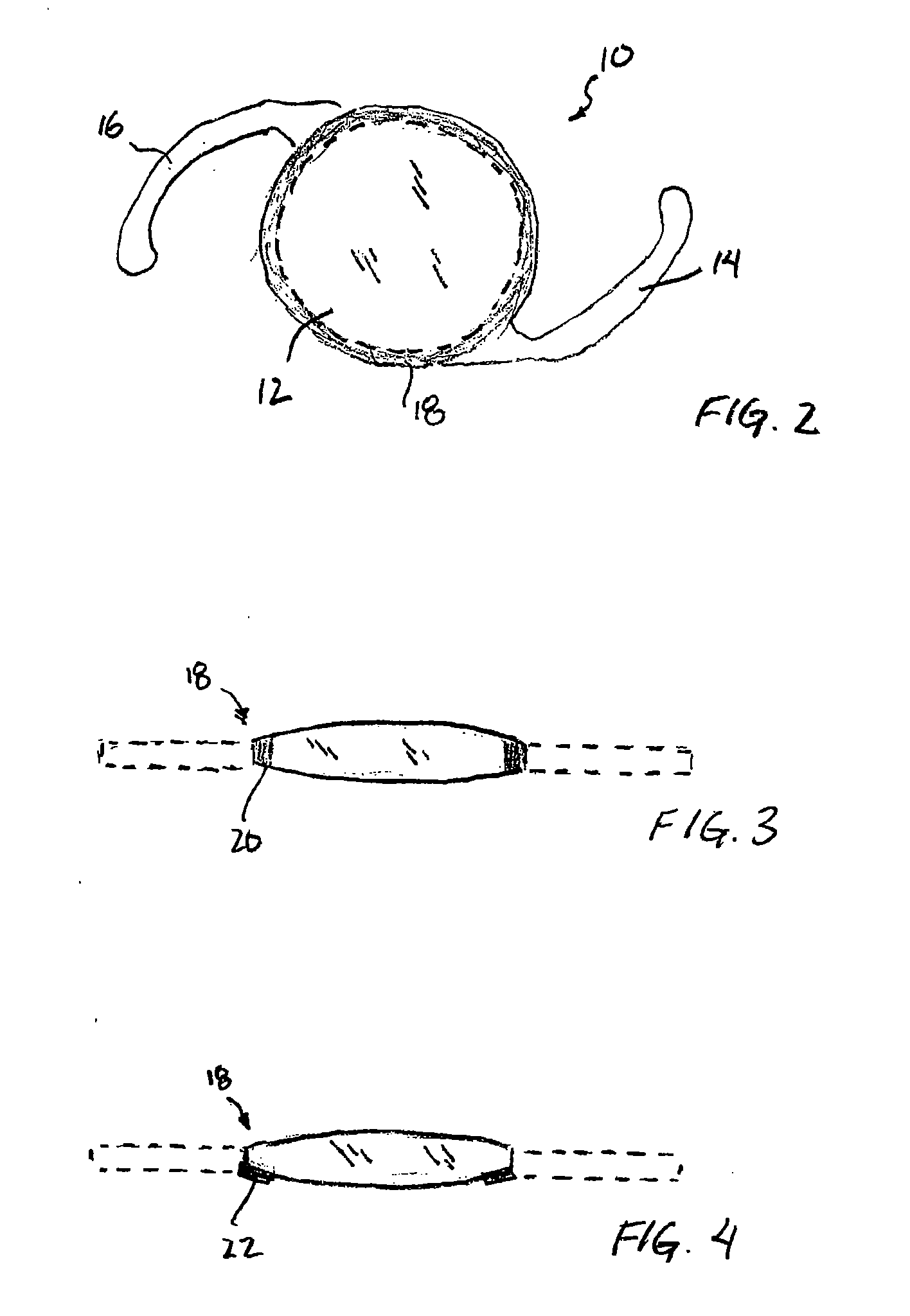 Intraocular lens with edge modification