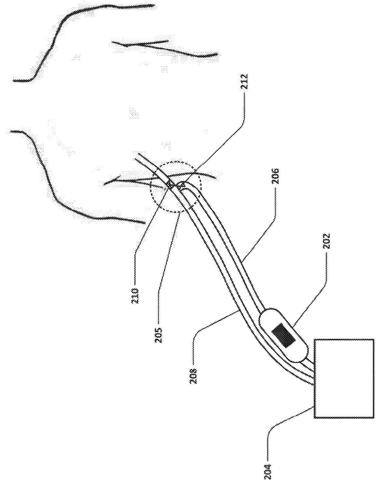 Devices and methods for managing chest drainage