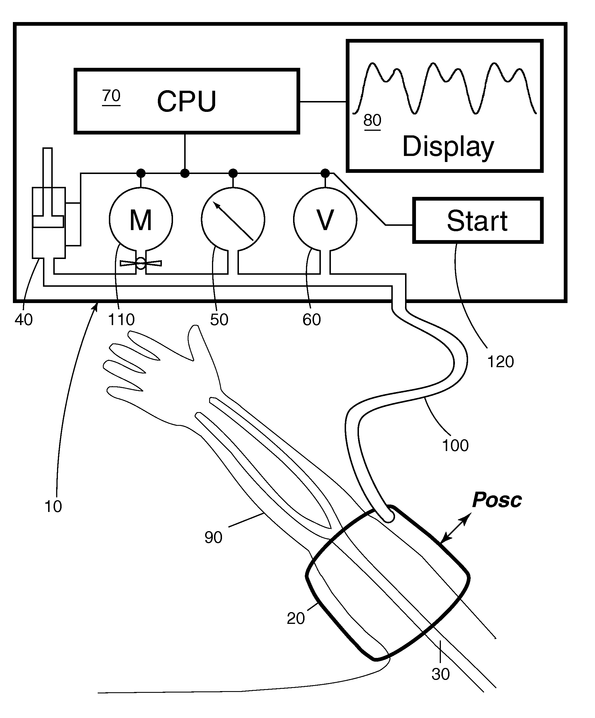 Noninvasive Method and Apparatus to Measure Body Pressure Using Extrinsic Perturbation