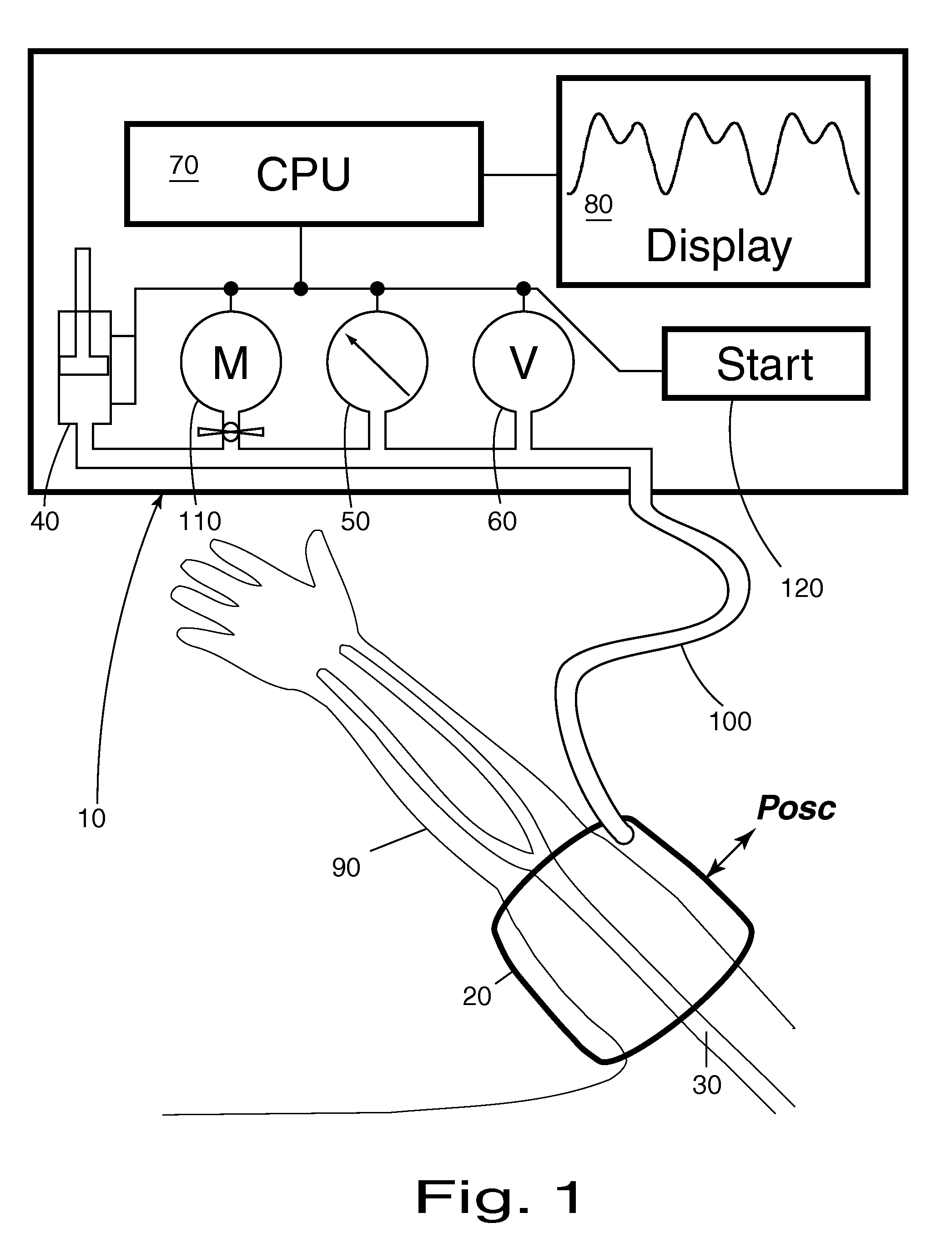 Noninvasive Method and Apparatus to Measure Body Pressure Using Extrinsic Perturbation