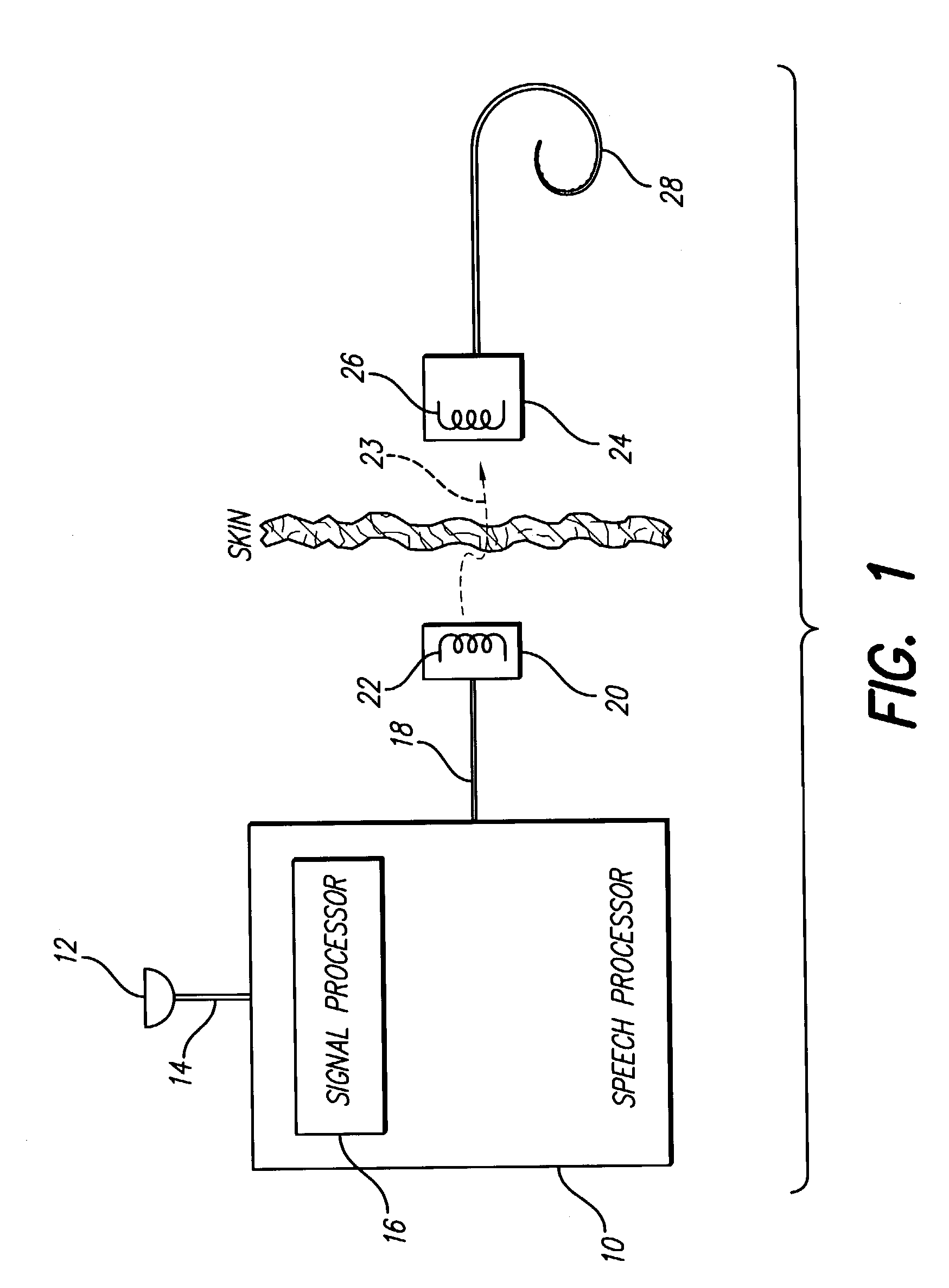 Distributed compression amplitude mapping for cochlear implants