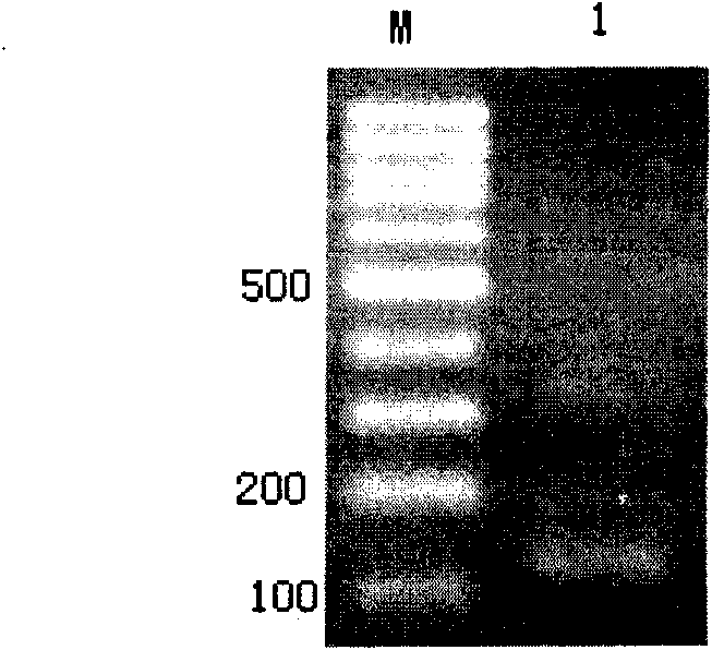 TaqMan probe for real-time fluorescence PCR (Polymerase Chain Reaction) detection of angiostrongylus cantonensis infected snails