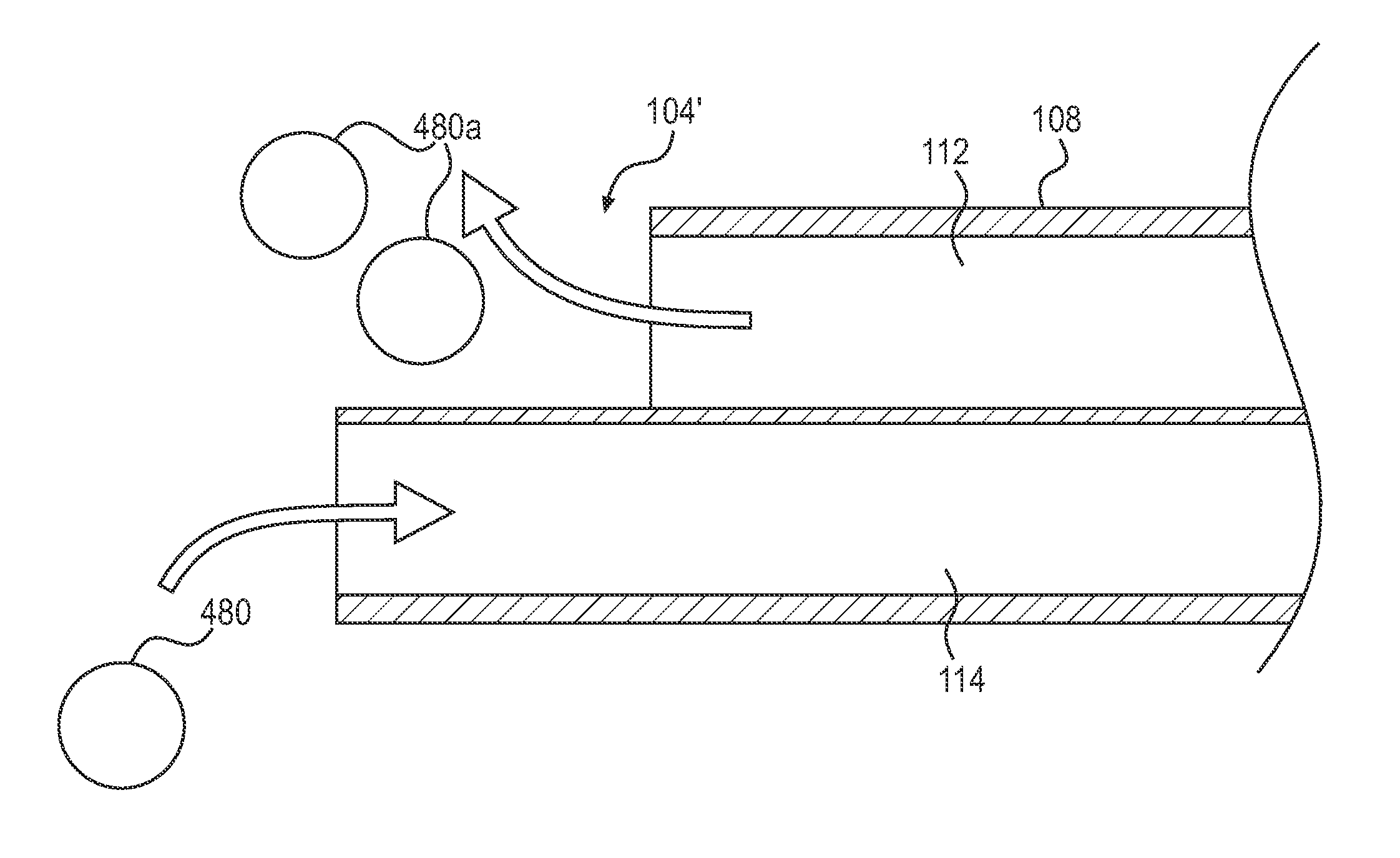 Medical device for removing particles