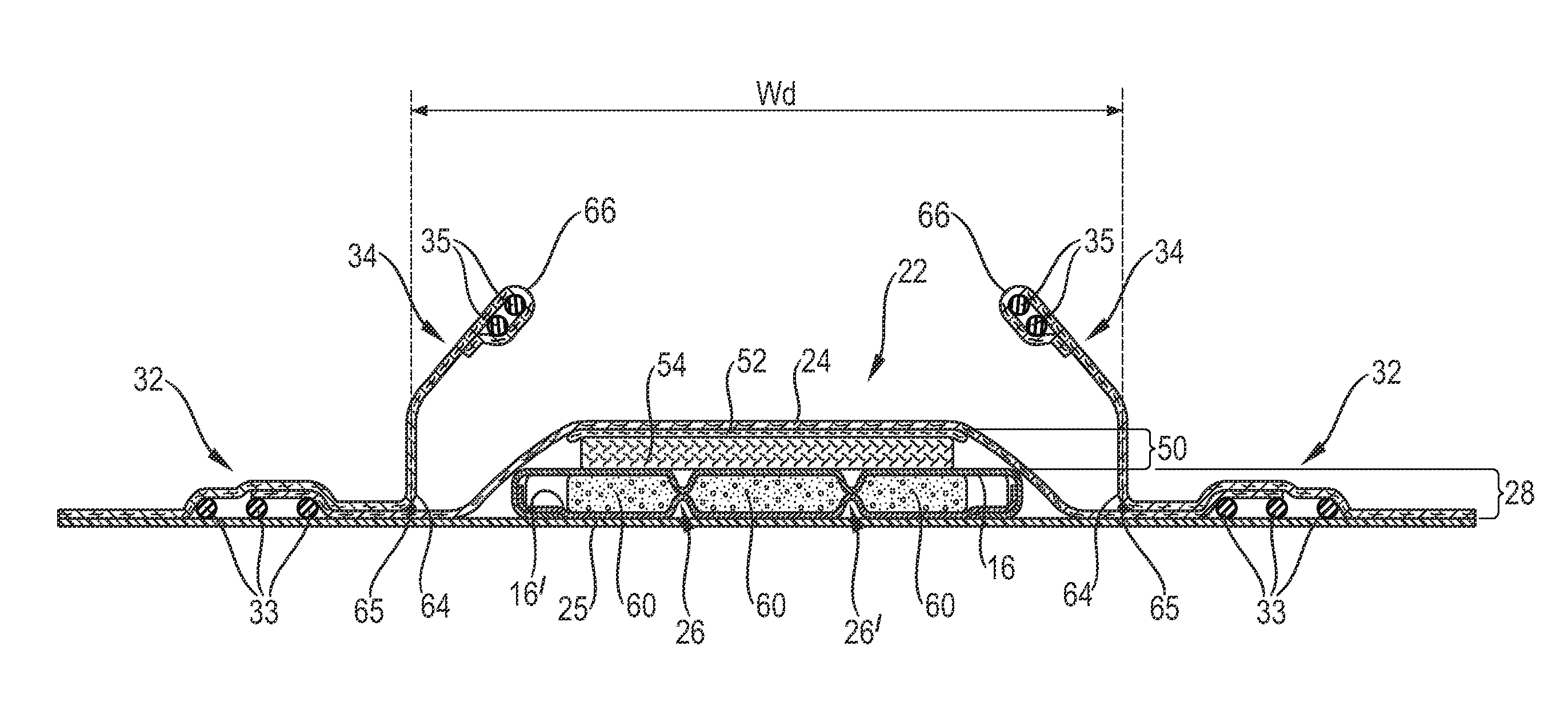 Absorbent article with high absorbent material content