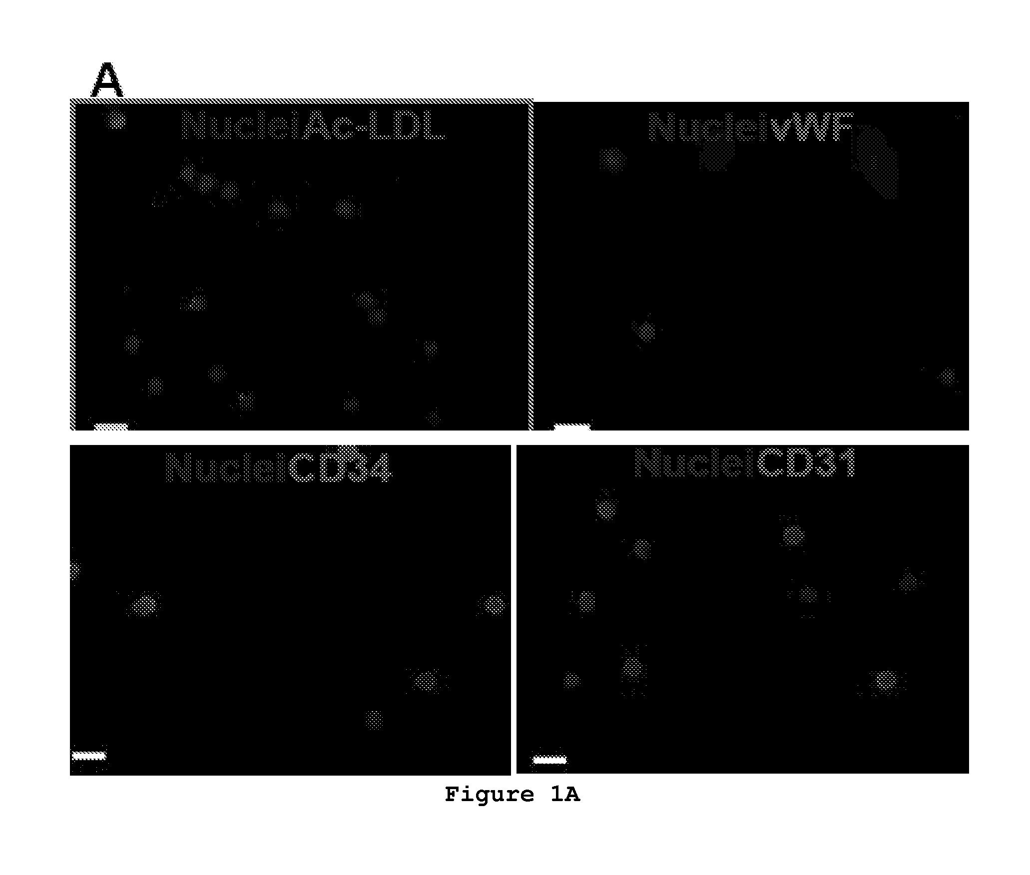 Composition and method to improve the therapeutic effect of stem cells