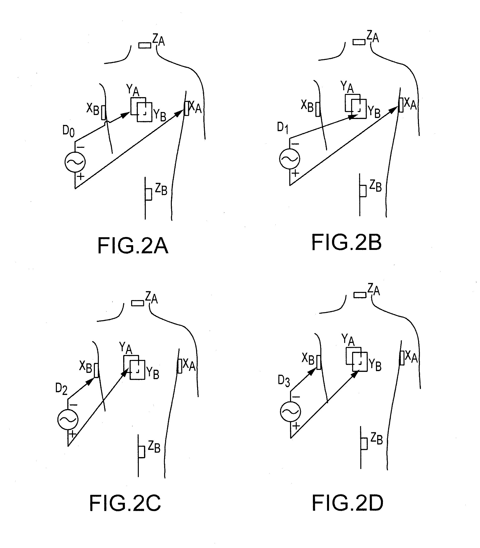 Regularization schemes for non-contact mapping with a medical device