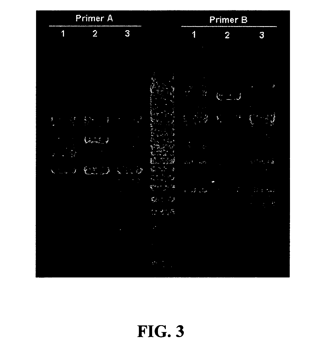 Method and composition for reducing E. coli disease and enhancing performance