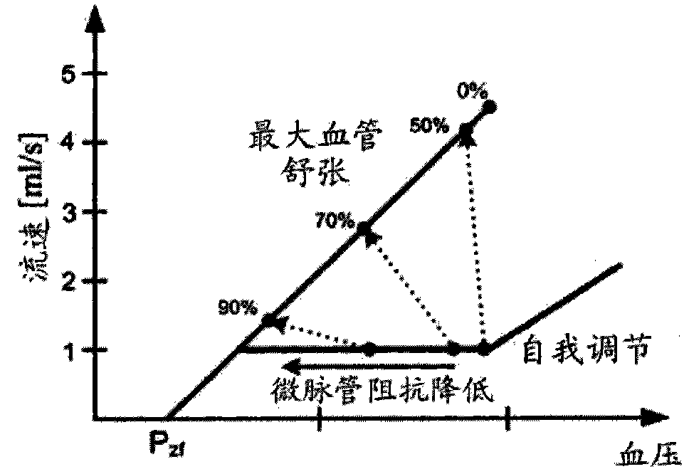 Method and system for non-invasive computation of hemodynamic indices for coronary artery stenosis