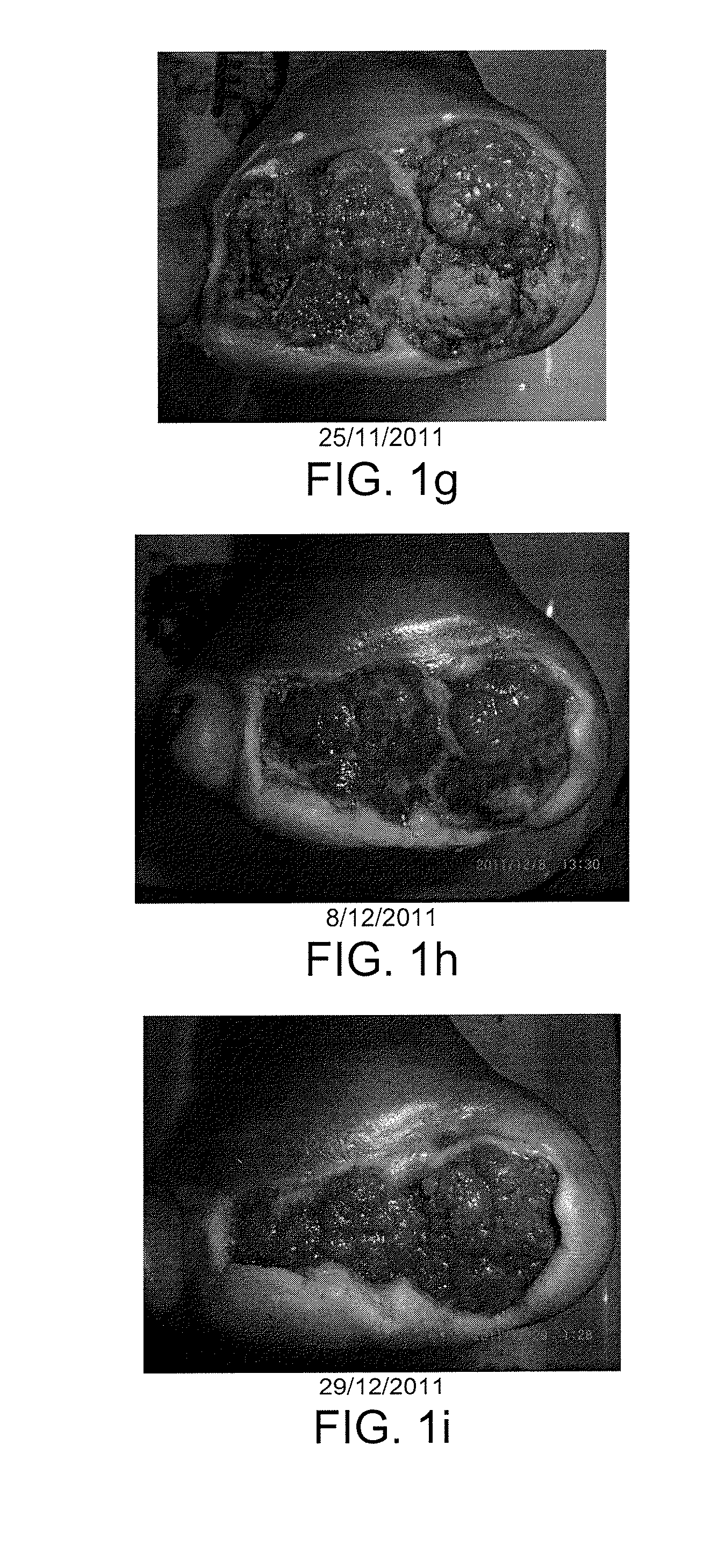 Compositions for the debridement, granulation and reepithelialization of wounds in man