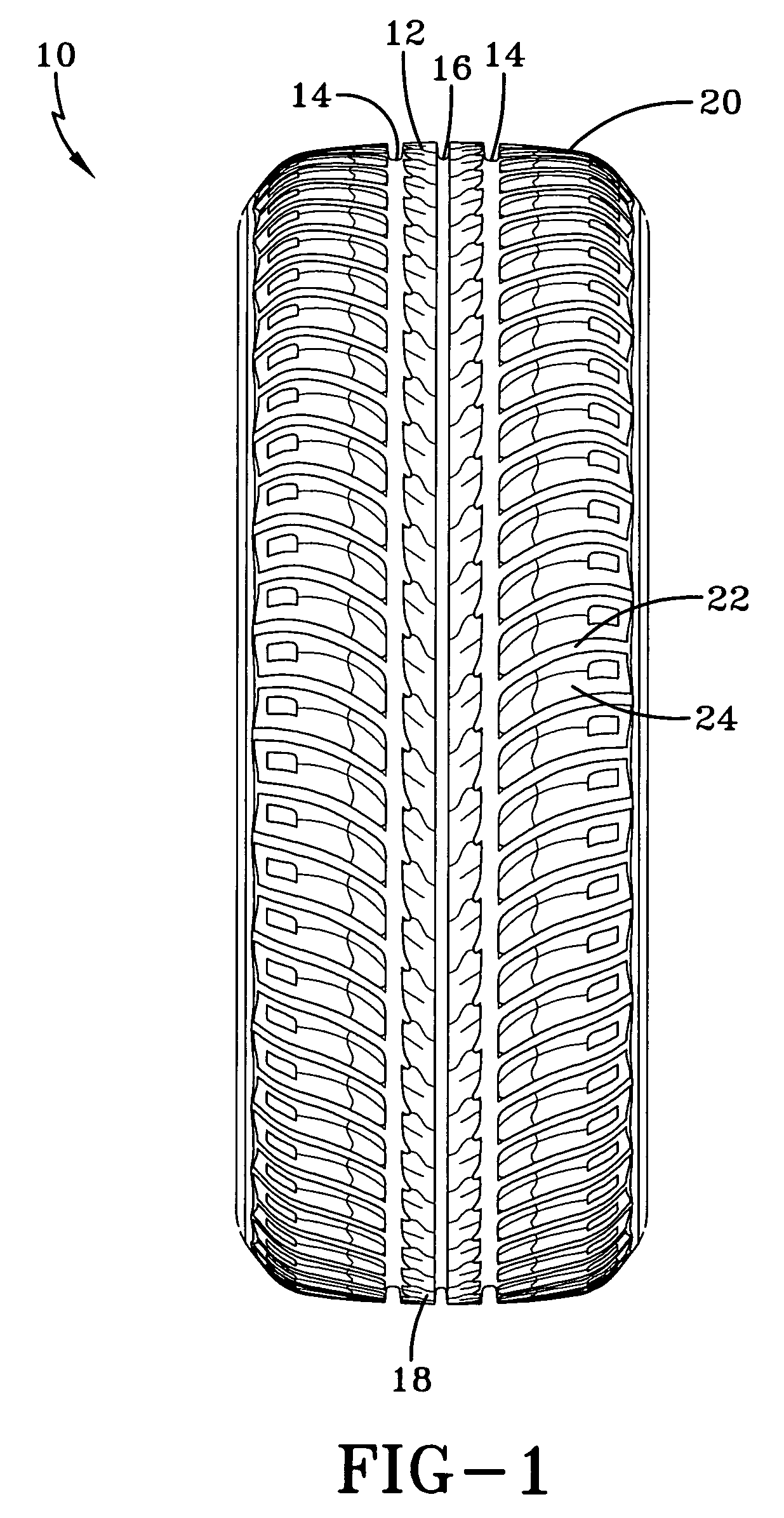 Tire with tread having crossed configuration sipe