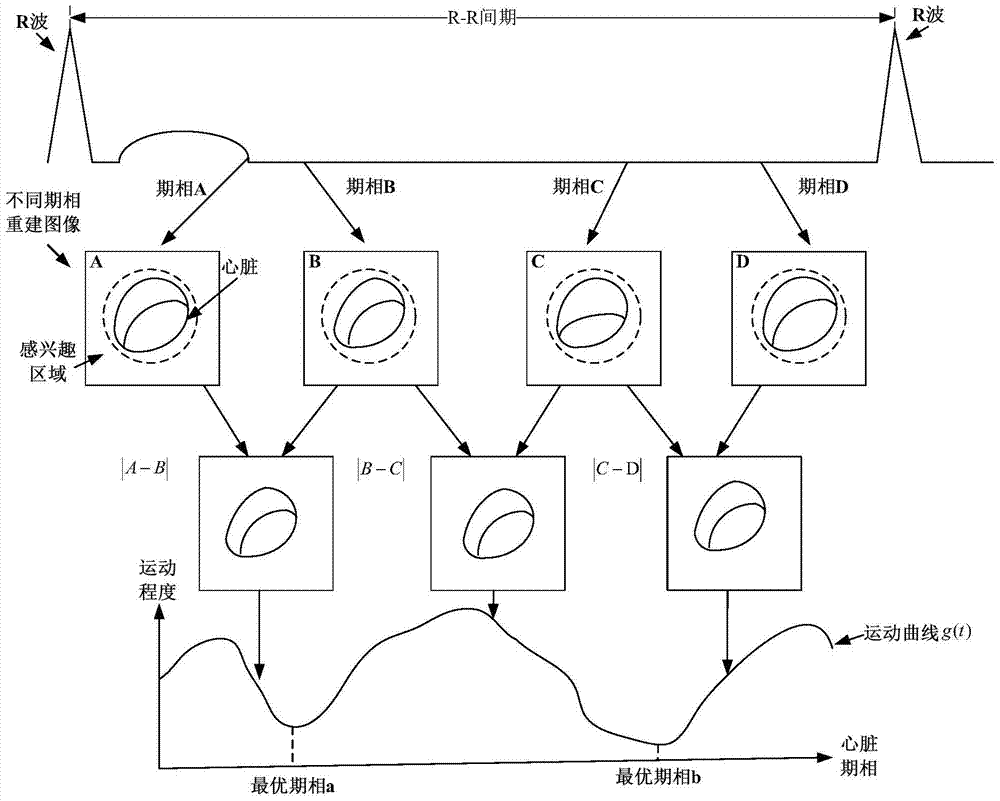 Heart CT scan method and device