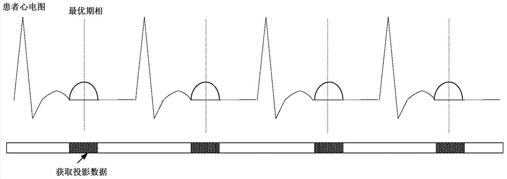 Heart CT scan method and device