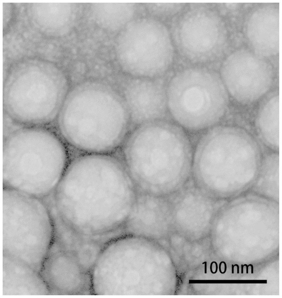 Bionic cell membrane-inner core nanoparticle as well as preparation method and application thereof