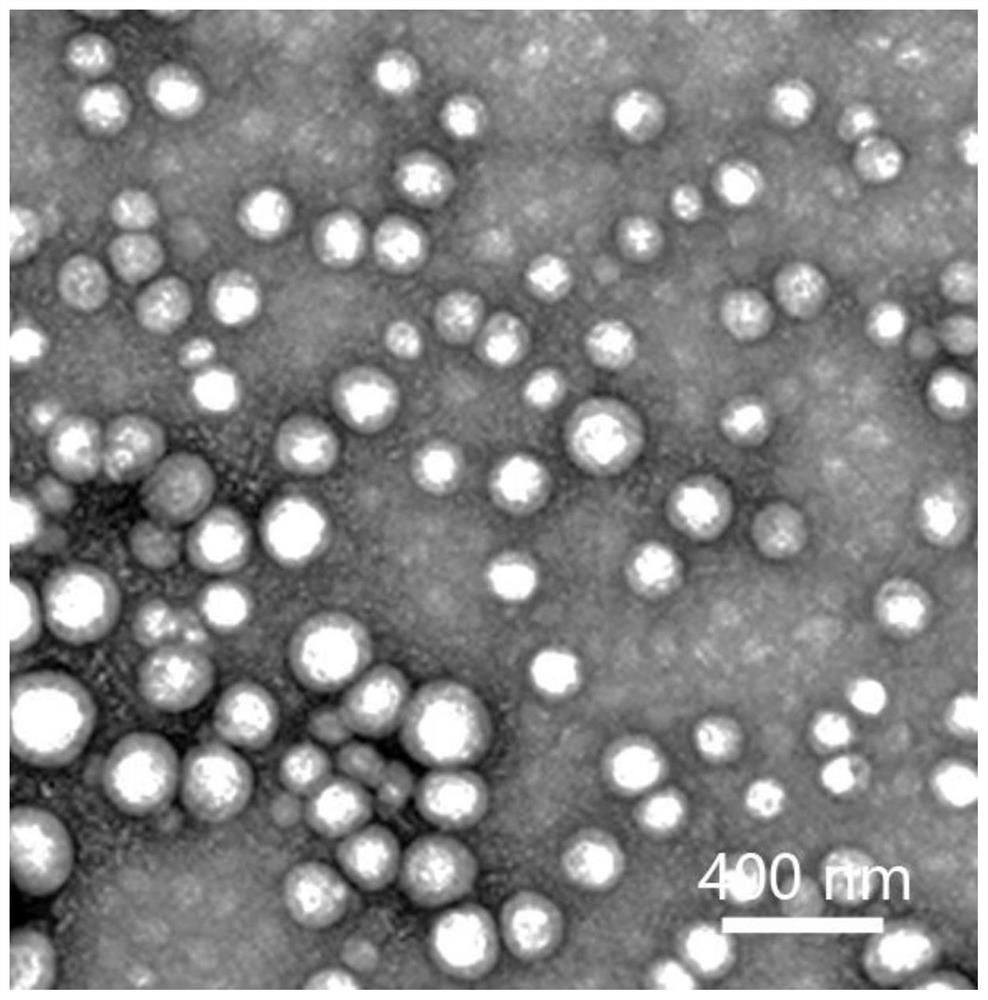 Bionic cell membrane-inner core nanoparticle as well as preparation method and application thereof