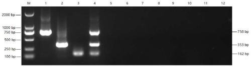 Triple PCR kit for diagnosing FHT/MP/HPS and detection method of triple PCR kit