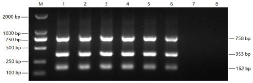 Triple PCR kit for diagnosing FHT/MP/HPS and detection method of triple PCR kit