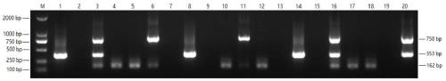 Triple PCR kit for diagnosing FHT/MP/HPS and detection method of triple PCR kit