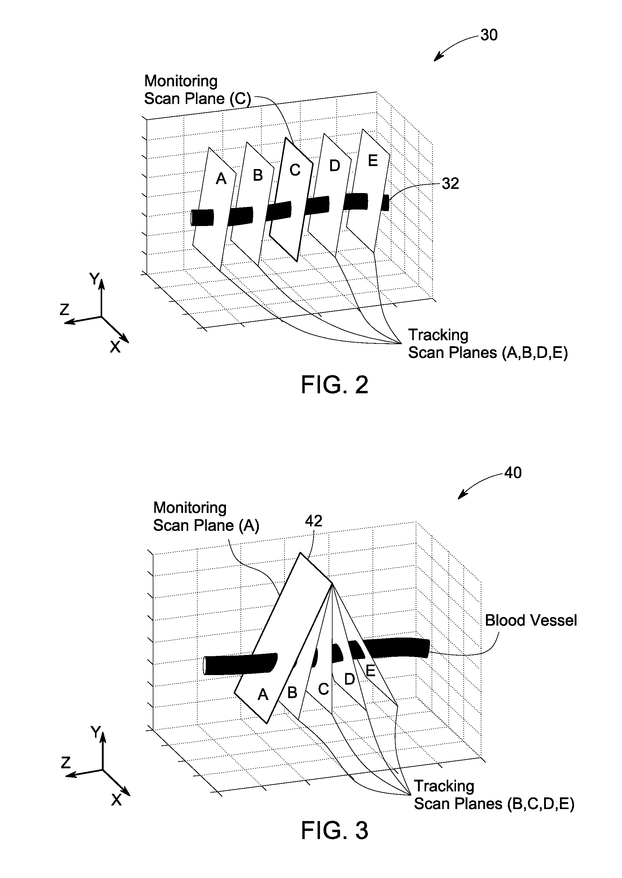 Method and system for non-invasive monitoring of patient parameters