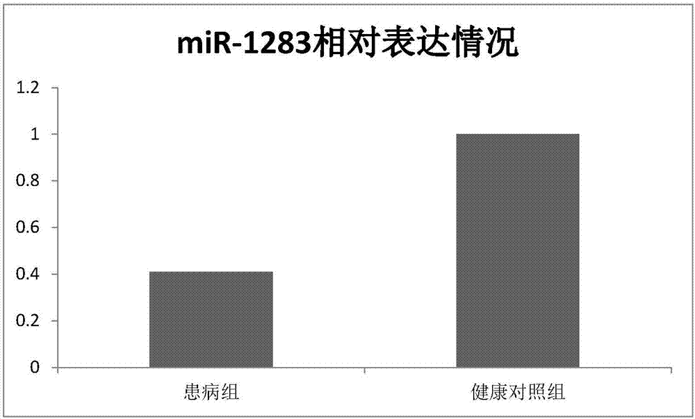 Myocardial infarction biomarker miR-1283