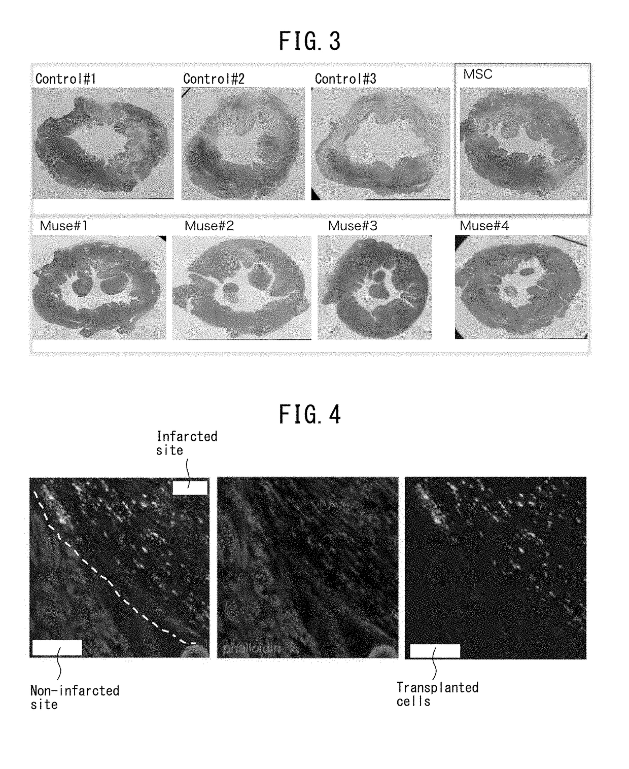 Pluripotent stem cell that induces repair and regeneration after myocardial infarction