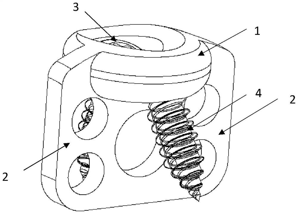 Vertebral plate replantation fixing device capable of grafting bone