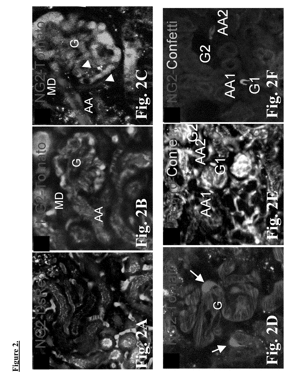 Targeting macula densa cells as a new therapeutic approach for kidney disease