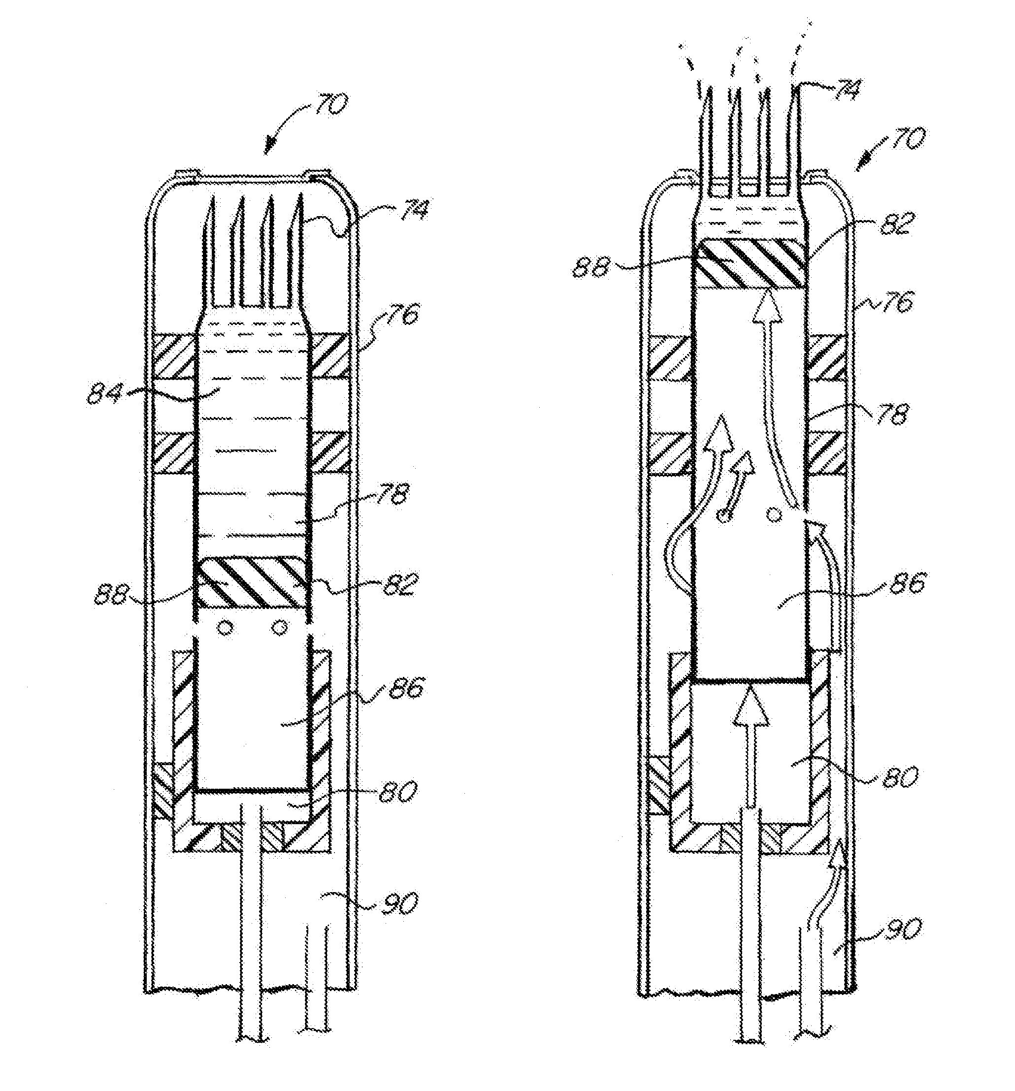 Treatment of hypoxic tumors with localized oxygenation