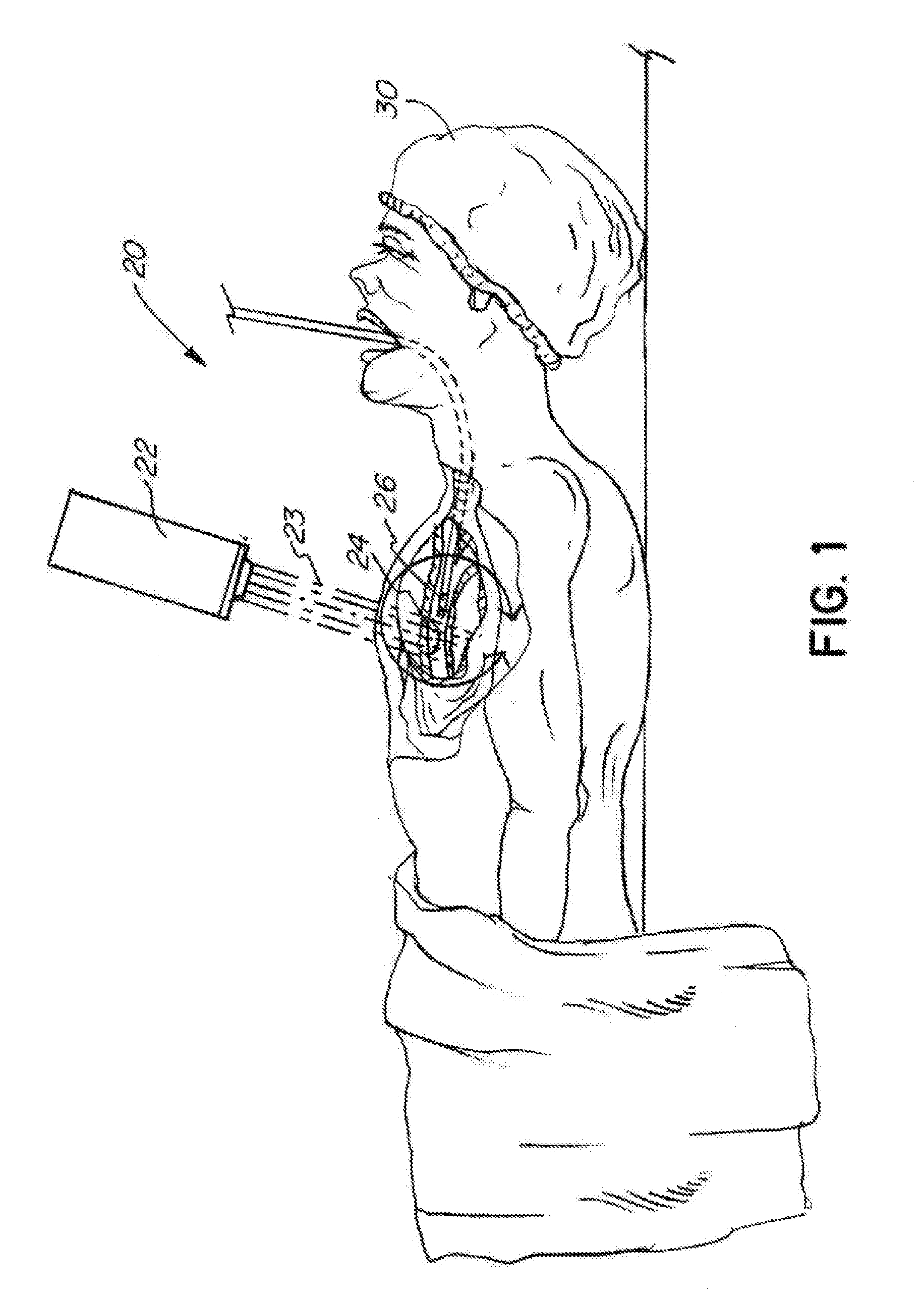 Treatment of hypoxic tumors with localized oxygenation