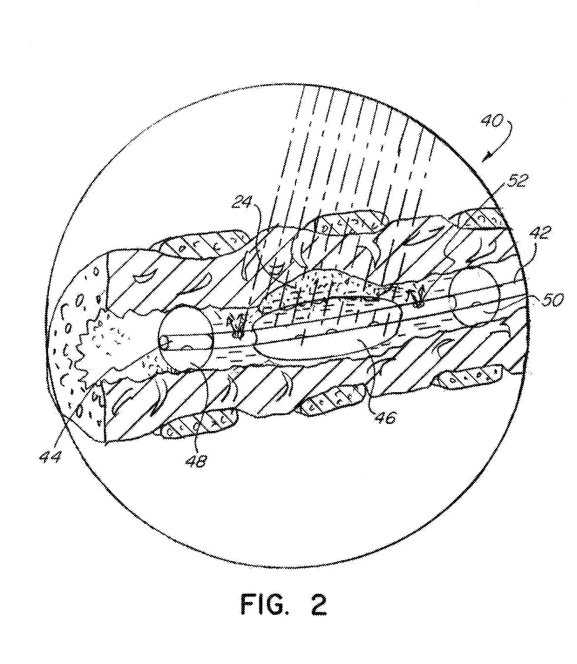 Treatment of hypoxic tumors with localized oxygenation