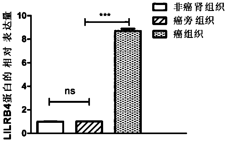 Biological marker related with clear cell renal cell carcinoma and application thereof