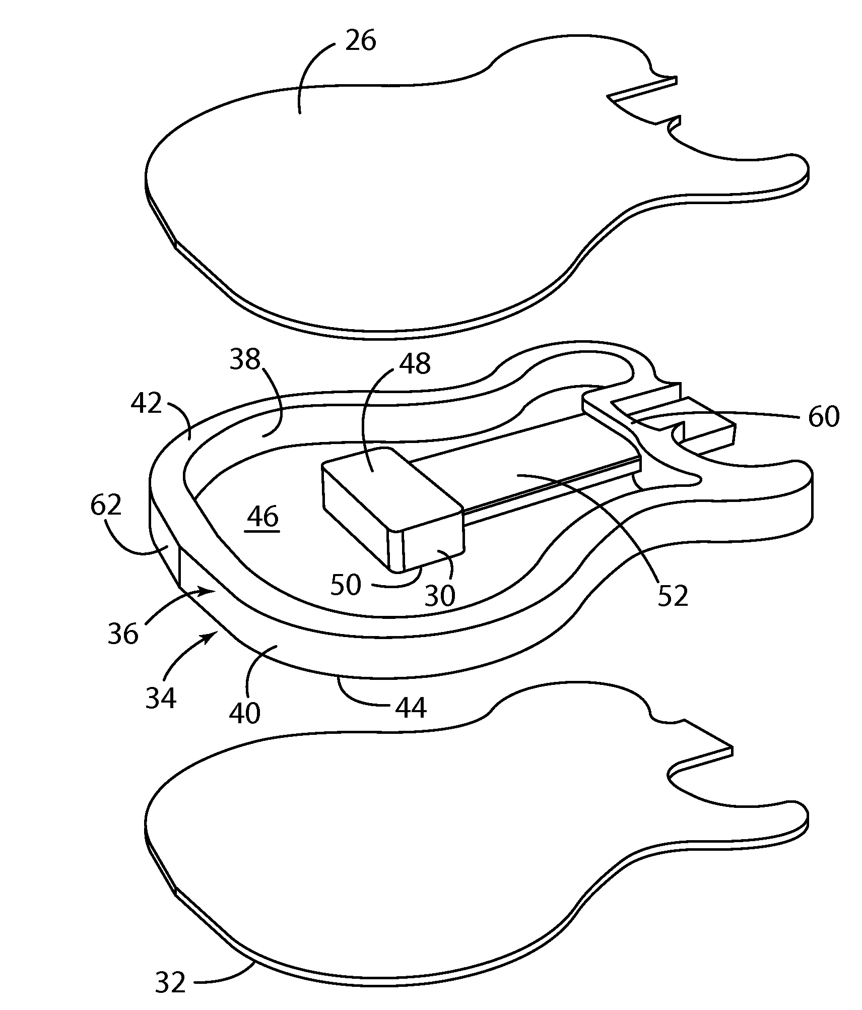 Structure for musical instrument body