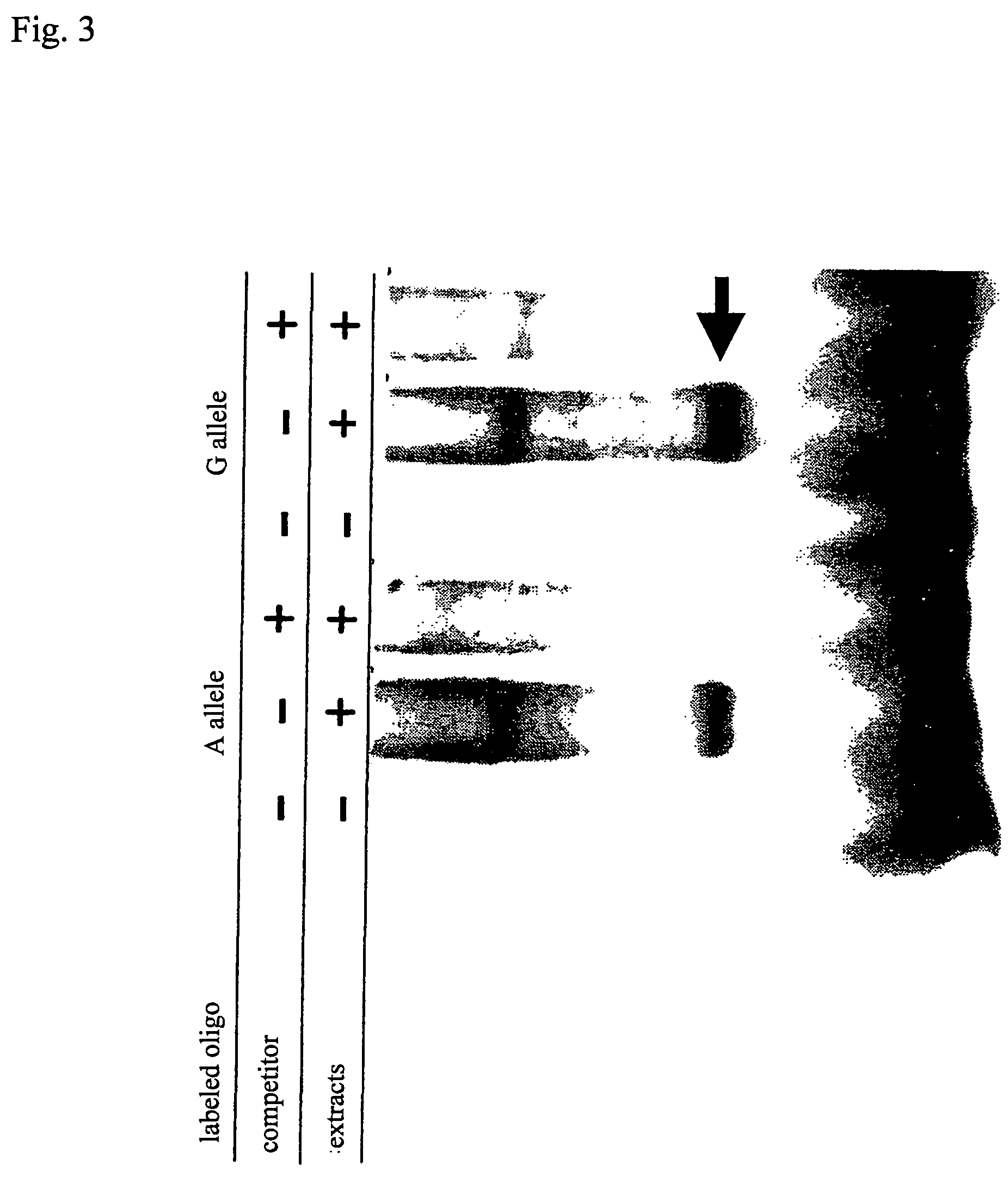 Method of judging inflammatory disease