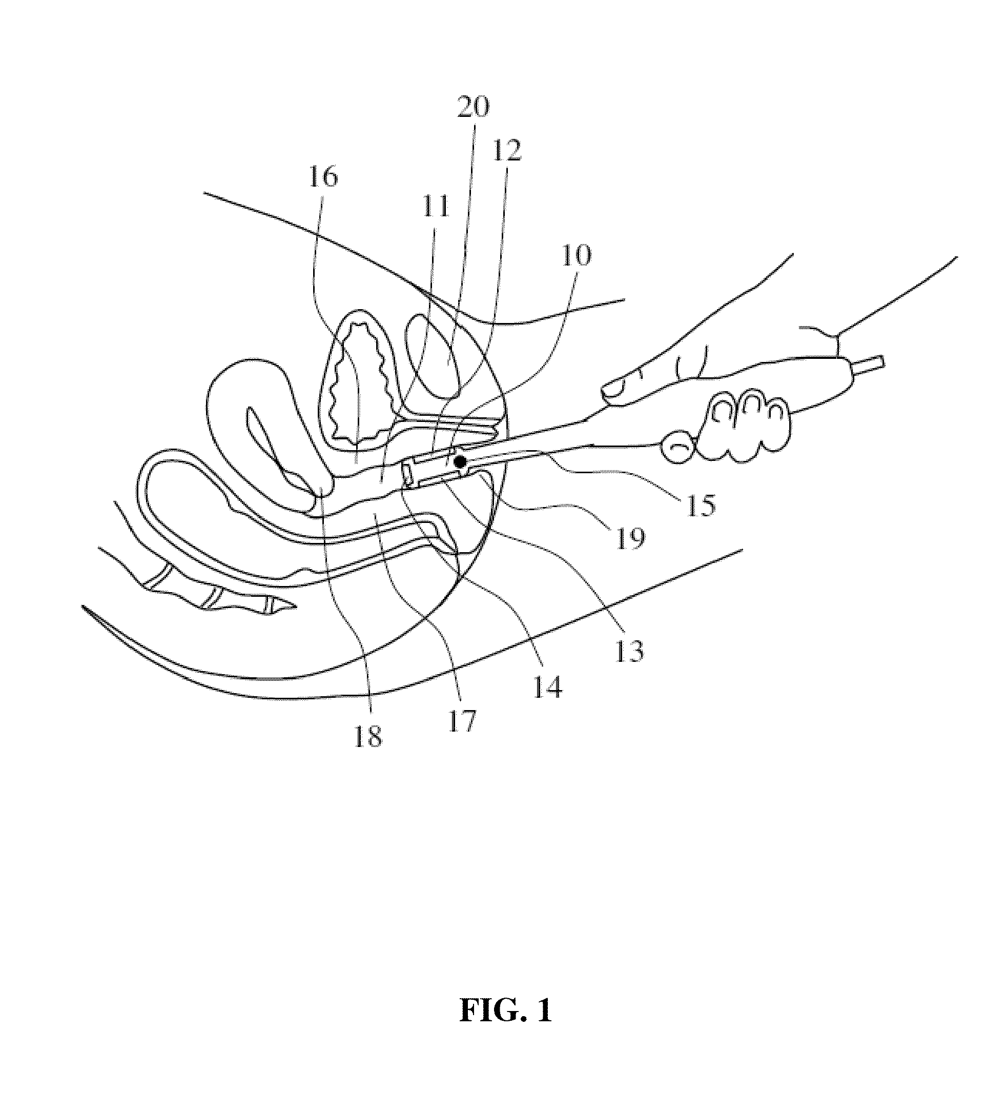 Methods and devices for biomechanical assessment of pelvic floor including perineum prior to childbirth