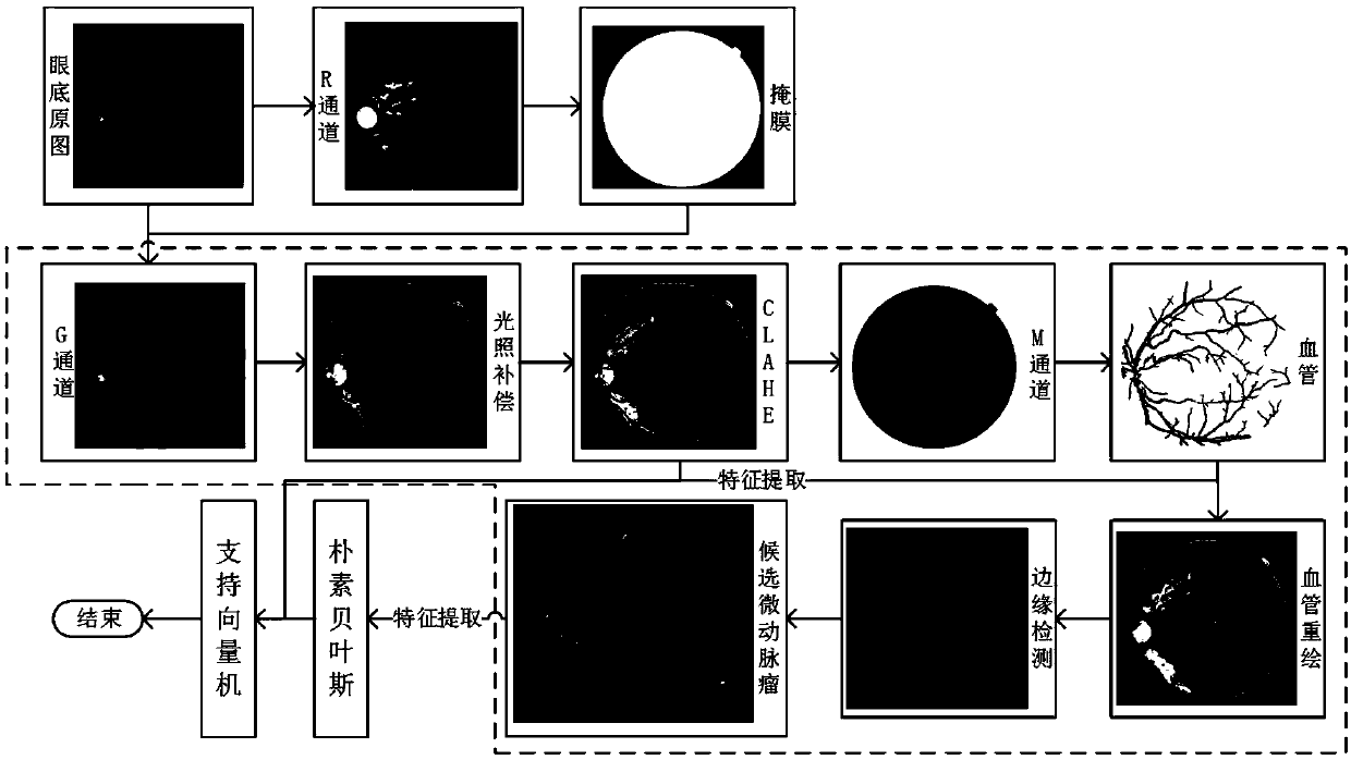 Automatic screening method for diabetic retinopathy based on naive Bayes and support vector machine