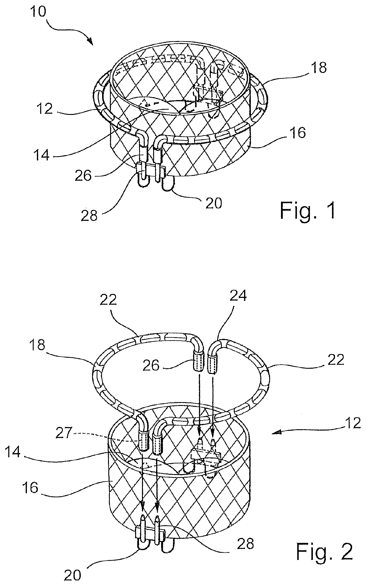 Device for implanting a prosthesis for a heart valve and assembly procedure