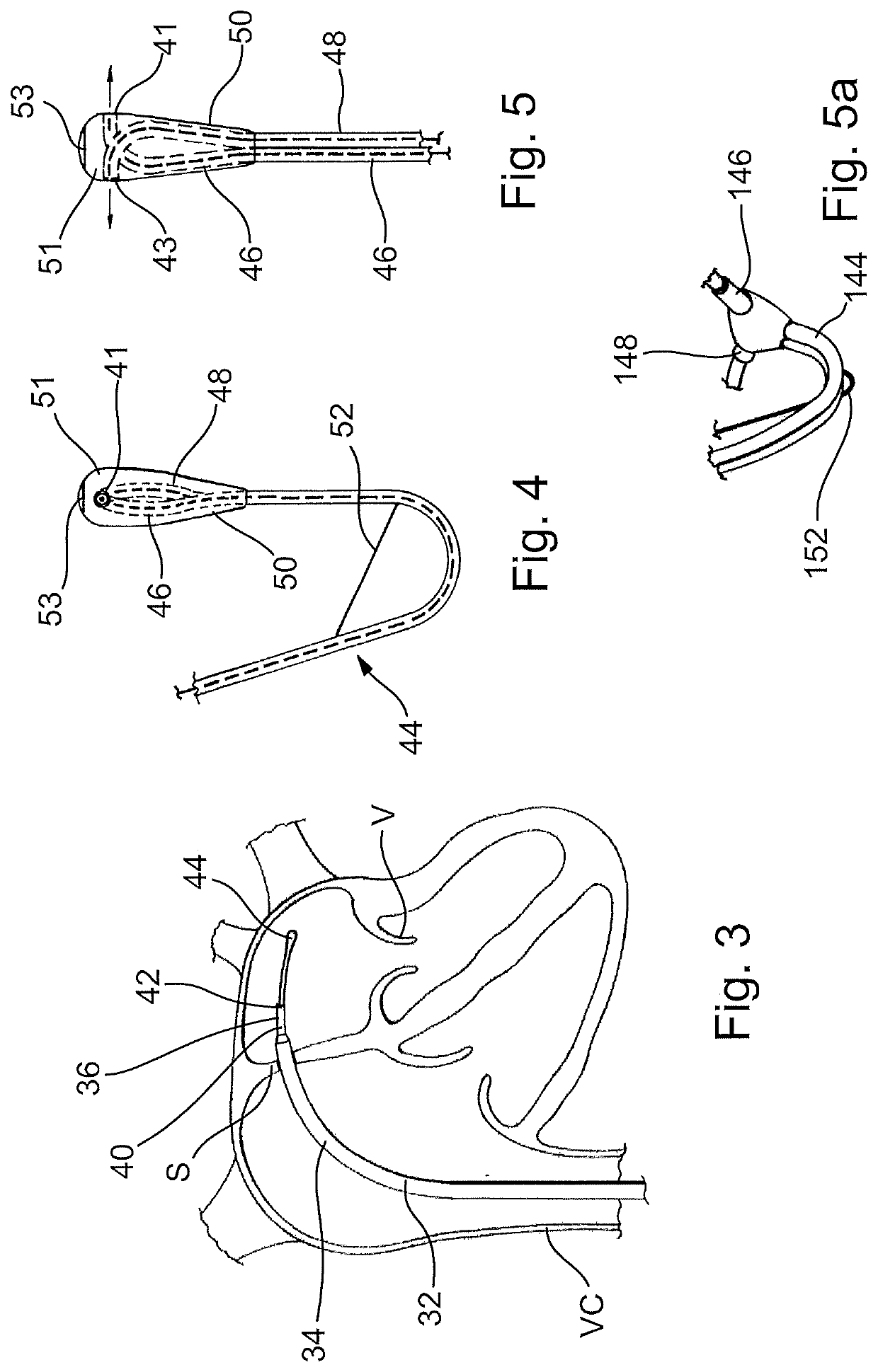 Device for implanting a prosthesis for a heart valve and assembly procedure