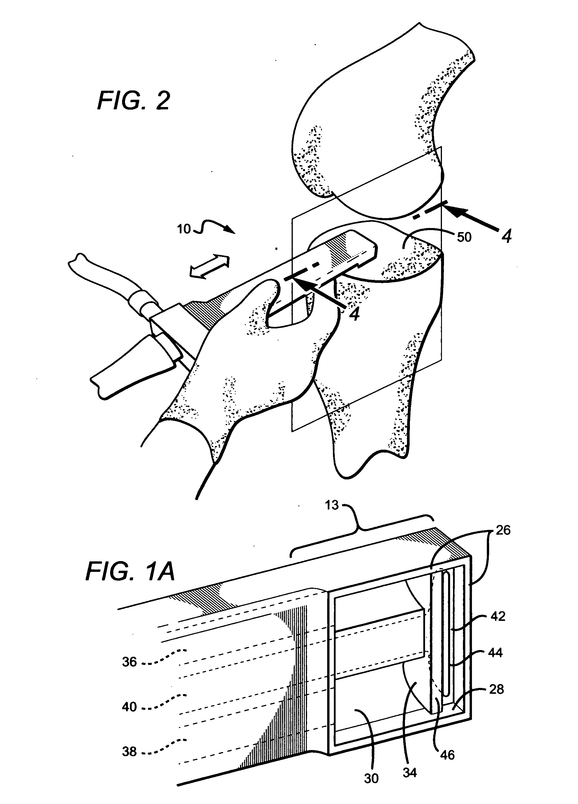 Apparatus and method for cleaning a surgically prepared bone surface