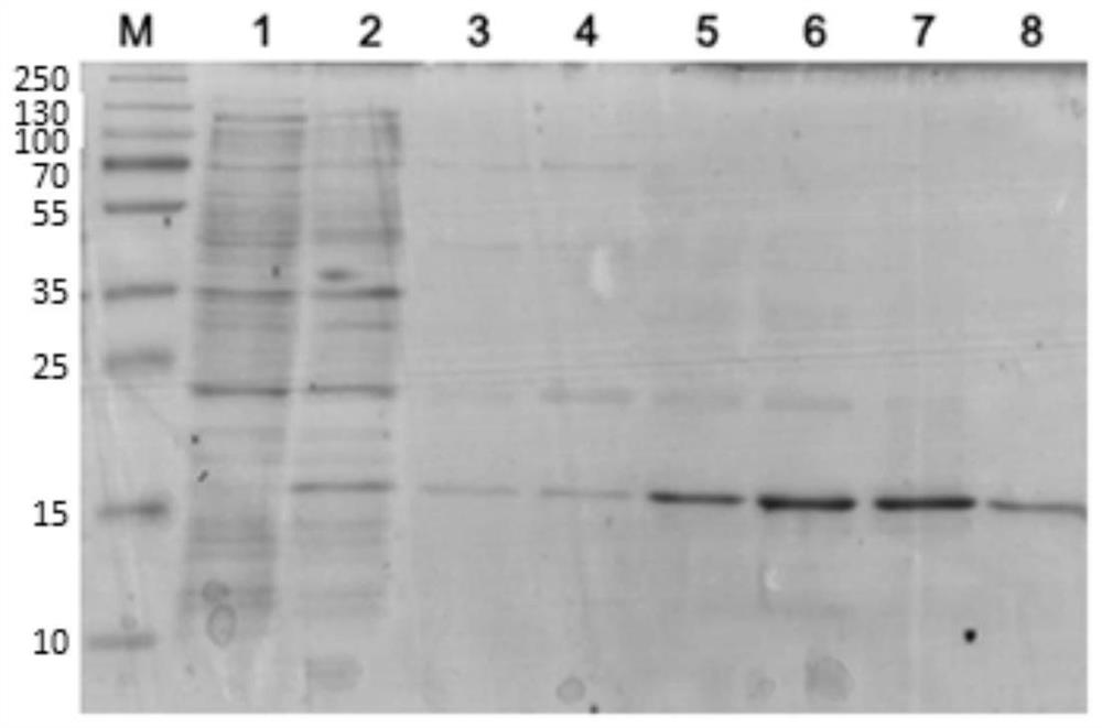 Nanobody, nucleic acid molecule and application of anti-human chorionic gonadotropin beta subunit