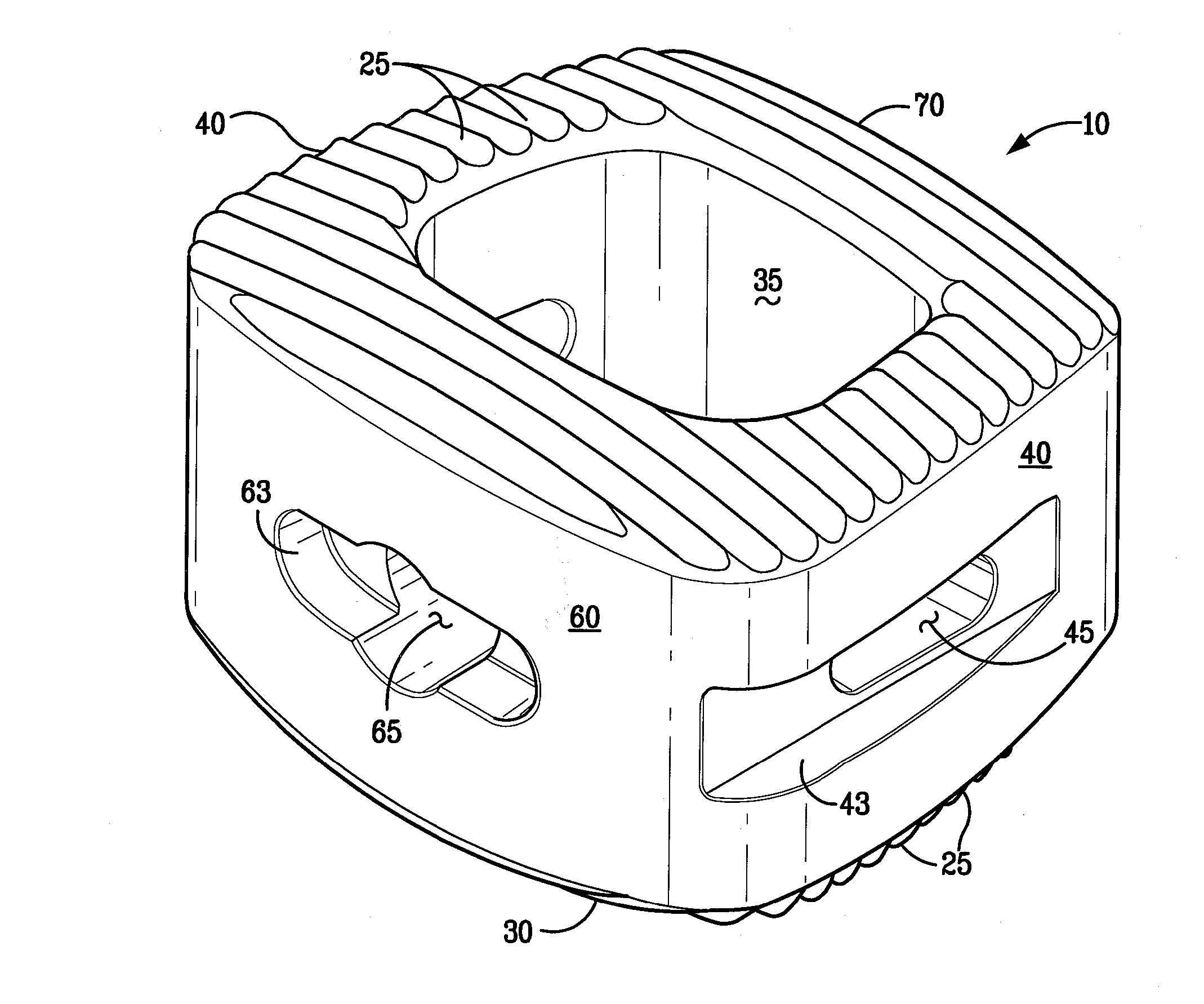 Bioactive Spinal Implants and Method of Manufacture Thereof