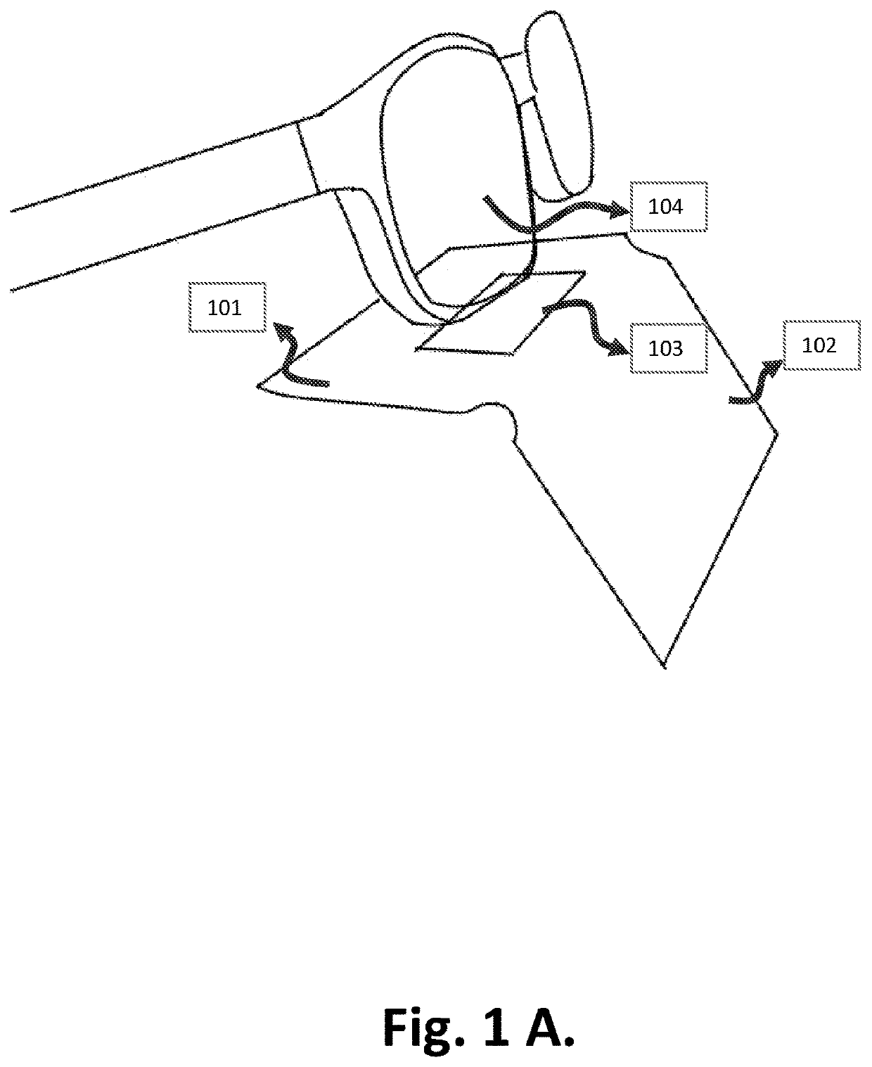 Anti-Fog Medical Face Mask and A Device for Preventing Formation of Fog on Eyewear while Wearing Face Cover