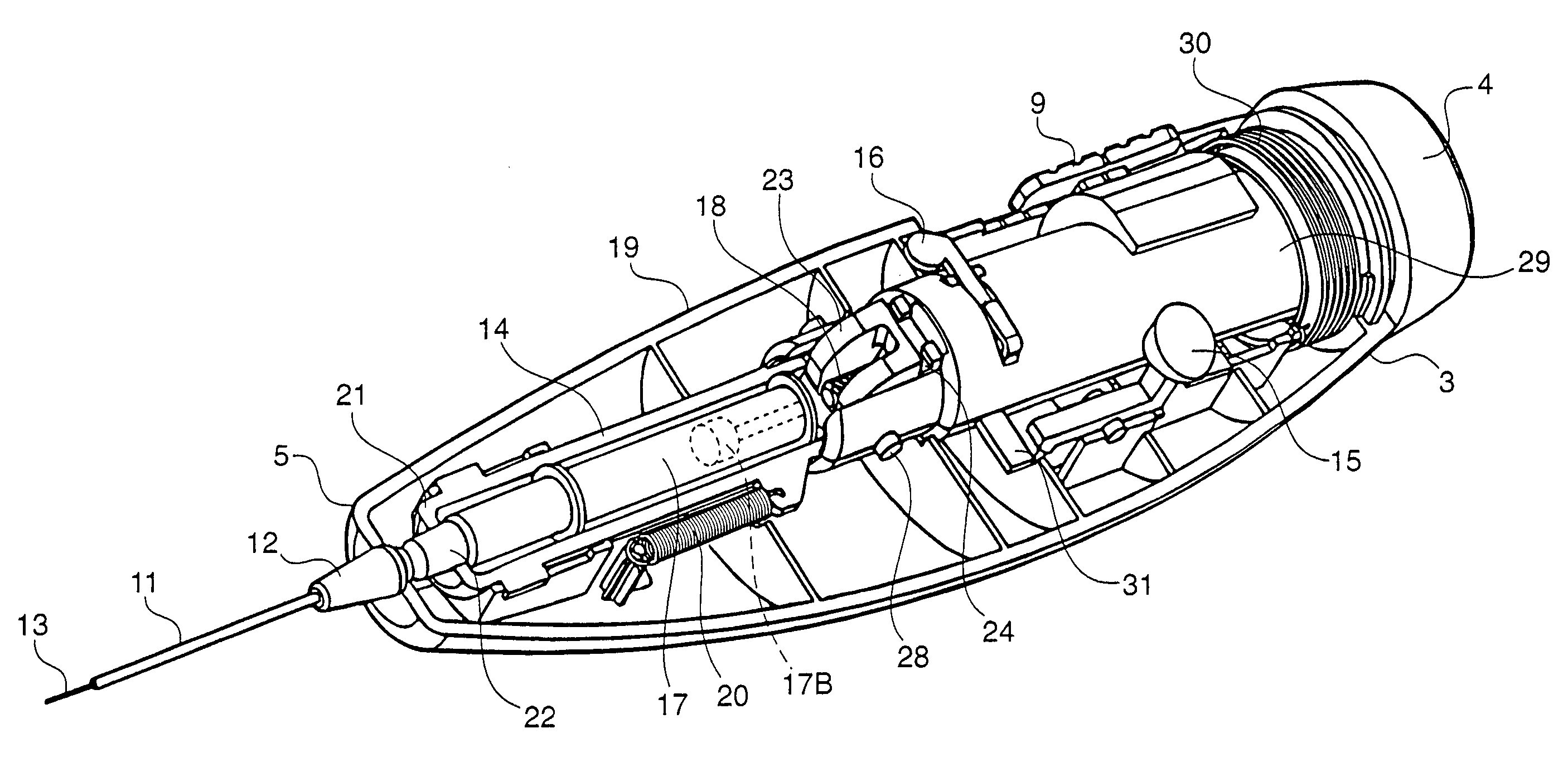 Catheter device and method for delivering a dose internally during minimally-invasive surgery
