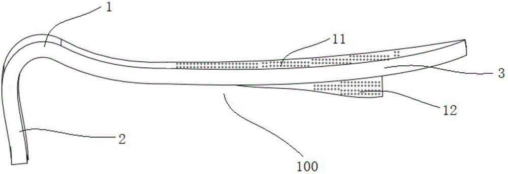 Allogeneic decalcified bone and titanium stent combined material for rhinoplasty filling and preparation method of allogeneic decalcified bone and titanium stent combined material